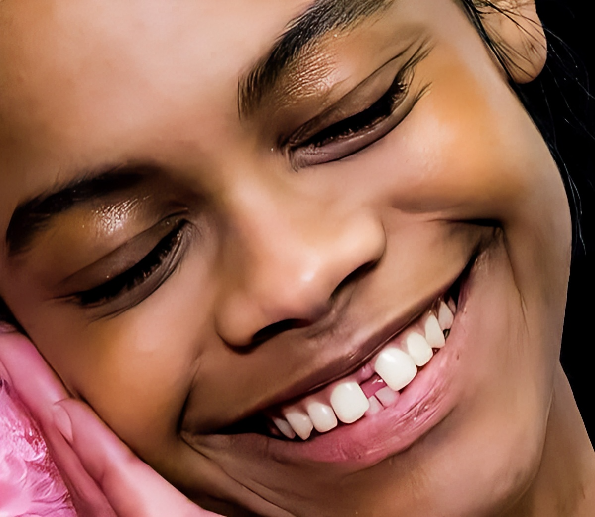 Dental Diastema Treatment with Composite Restoration
